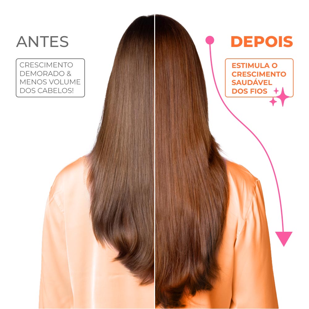 Aynê Cresce Mais Hair Boost